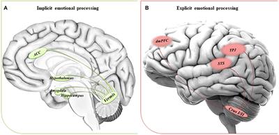 Implicit vs. Explicit Emotion Processing in Autism Spectrum Disorders: An Opinion on the Role of the Cerebellum